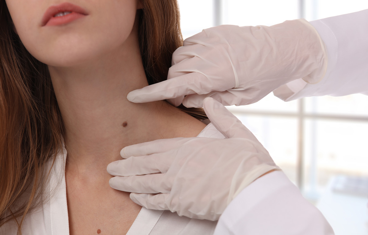 Skin-checks-banner