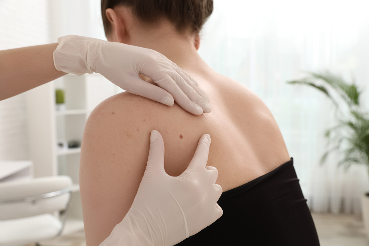skin-check_3