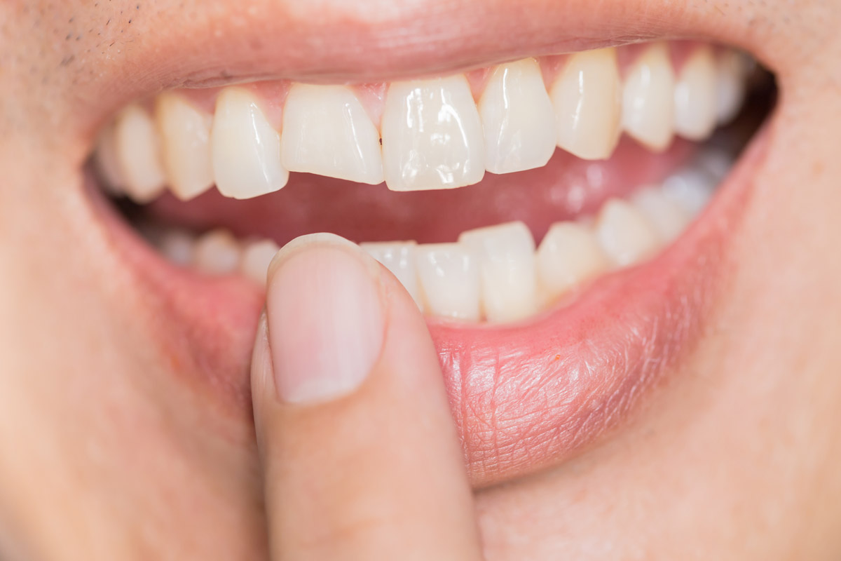 urgent_dental1